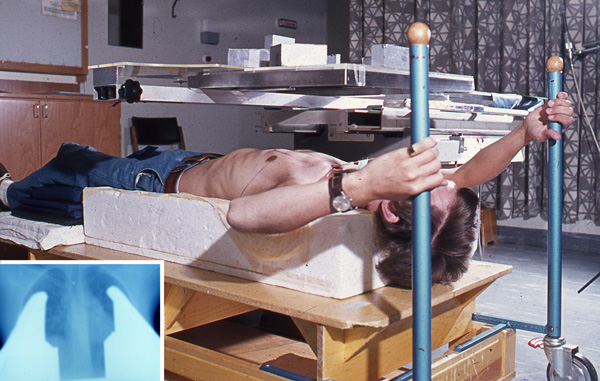 Mantelbehandling