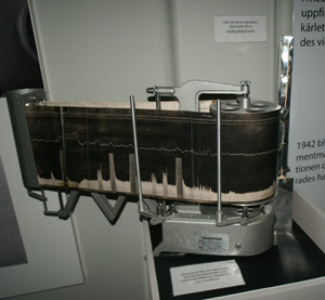 Kymograf