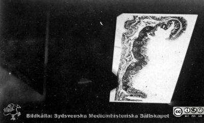 1928 års kurs i histologi i Lund
Fotoalbum märkt Histologikursen anno 1928. 
Detta album innehåller bilder från dåvarande histologiska avdelningen på anatomiska institutionen i Lund på Biskopsgatan 7. Liksom de övriga i serien skapades det av kursdeltagarna och tillägnades kursledaren professor Torsten Hellman som uppskattning av hans lärargärning. Bildtext  saknas. Kanske en projicerad mikroskopbild av tarmludd. 
Bildkälla Stiftelsen Locus Medicus Lundensis 250317.
Nyckelord: Locus Medicus Lundensis;Medicinska fakulteten i Lund;Histologiska avdelningen;Sydsvenska Medicinhistoriska Sällskapet;SMHS;Anatomiska Institutionen;Studenter;Lärare