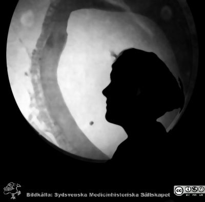 1928 års kurs i histologi i Lund
Fotoalbum märkt Histologikursen anno 1928. 
Detta album innehåller bilder från dåvarande histologiska avdelningen på anatomiska institutionen i Lund på Biskopsgatan 7. Liksom de övriga i serien skapades det av kursdeltagarna och tillägnades kursledaren professor Torsten Hellman som uppskattning av hans lärargärning. Bildtext  "Margit Svensson.". Siluett mot mikroskopprojektorns runda skiva med en bild av ett blodkärl i den.
Bildkälla Stiftelsen Locus Medicus Lundensis 250317.
Nyckelord: Locus Medicus Lundensis;Medicinska fakulteten i Lund;Histologiska avdelningen;Sydsvenska Medicinhistoriska Sällskapet;SMHS;Anatomiska Institutionen;Studenter;Lärare
