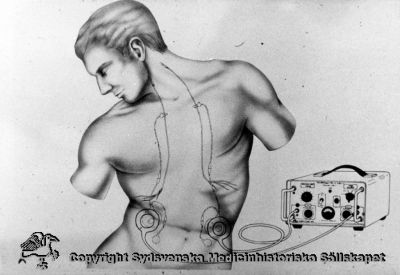 Rimligen transkutan stimulering av vagusnerven med implanterade elektroder.
Omonterat fotografi med påskrift "Diagnostik" som enda märkning. 
Bilden visar dock mest sannolikt principen för utrustning för transkutan stimulering av vaguselektroder.
Nyckelord: Vagus;Elektroder;TNS;Transkutan;Stimulering
