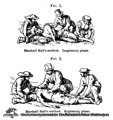 Instruktion i konstgjord andning
Reprofotgrafi. Påskrift med handstil: Konstgjord andning.
Nyckelord: Konstgjord;Andning;Marshall;Hall;Metod