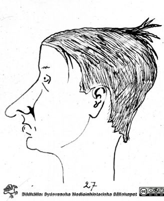 Fotoalbum märkt Histologikursen Ht. 1927 på första bladet.
Fotoalbum märkt Histologikursen Ht. -27 på första bladet. Det innehåller bilder från dåvarande histologiska avdelningen 
på anatomiska institutionen i Lund på Biskopsgatan 7. Bildtext "Nordlind." Bilden visar troligen en karikatyr av en kursdeltagare. Den är inte signerad. 
Bildkälla Stiftelsen Locus Medicus Lundensis 230317.
Nyckelord: Karikatyr;Universitet;Medicinska fakulteten i Lund;Histologiska avdelningen;Anatomiska Institutionen;Locus Medicus Lundensis;Medicine studerande