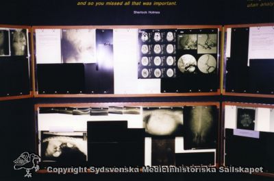 Röntgenutställningen, Medicinhistoriska Muséet,  Stockholm 2002
Foto utan ytterligare identifierande märkniong.
Nyckelord: Röntgenbilder;Ljusskåp;2002