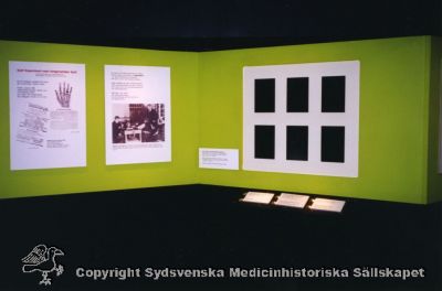 Röntgenutställningen, Medicinhistoriska Muséet,  Stockholm 2002
Foto utan ytterligare identifierande märkniong.
Nyckelord: Utställning