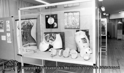 Medicinhistorisk utställning i seminariets bottenvåning nov. 1986. 
Foto: Ernst von Scheele. Monter och skärm med undervisningsmodeller (moulager) och anatomiska planscher.
Nyckelord: Monter;Skärm;Anatomi;Moulage;Undervisning;Undervisningsmodeller;Plansch;Foto;Omonterat;Kapsel 07