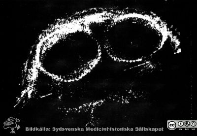 Världens första ultraljudsbild av tvillinggraviditet
Bilden togs 1962 av Bertil Sundén på kvinnokliniken i Lund. 
Nyckelord: Människa;Ultraljud;Graviditet;Tvillingar;Flerbörd