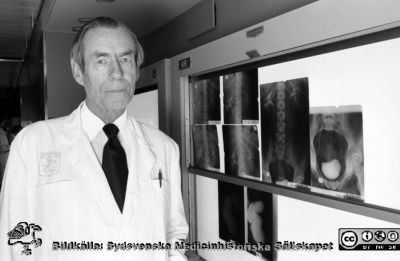 Röntgenologen, professor Olle Olsson 1977
Lasarettet i Lund. Album "Svart/vitt negativ 1977. 2". 122B. 77-12-05.	Negativ. Ej monterat. 
Nyckelord: Lund;Lasarett;Universitetssjukhus;Universitet;Röntgen;Rtg;Professor;Chefläkare;Administration;Direktion
