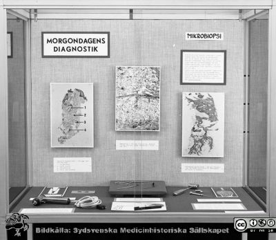 Medicinhistorisk utställningsmonter 1976
Sjukhusfotograferna i Lund. Pärm Negativ, S/V. 1976. 149. Medicinhistorisk monter 76. Morgondagens diagnostik. Mikrobiopsi. Från negativ. 
Nyckelord: Lasarettet;Lund;Universitet;Universitetssjukhus;USiL;Medicinhistoria;Utställning;Monter;Mikrobiopsi;Diagnostik;Undersökning;Teknik