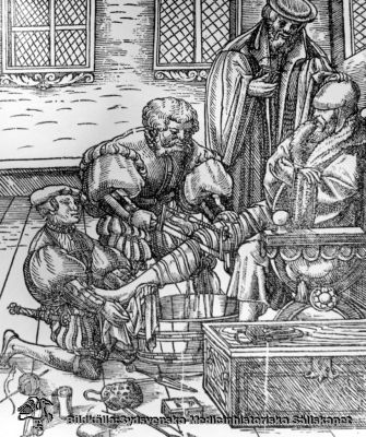 Amputation, 1500-talet
Kirurgi. Amputation. Reprofoto av träsnitt. Okänd mästare, 1500 - talet. Omonterat fotografi
Keywords: kirurgi;Amputation;Reproduktion;1500-TALET;Kapsel 09;foto;Omonterat