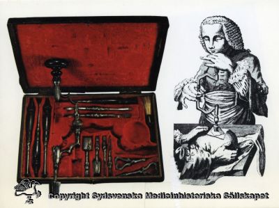 Medicinhistoriska samlingar i Lund 1987 - 92. Instrument för craniotomi
Medicinhistoriska samlingar 1987 - 92. Etui från slutet av sjuttonhundratalet med komplett instrumentuppsättning för craniotomi. Därinvid en bild av en skalltrepanering från en fransk encyclopedi från 1779. Postkort. Tryck: Berlings, Arlöv 1982. 
Nyckelord: Postkort;Trepanation;skrin;1700-talet;instrument;craniotomi;Monter;Lund;Universitetssjukhus;Lund;Tryck;Berlings;Ingemar;Nilsson;Kapsel 07