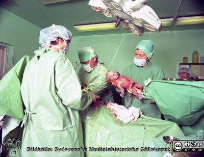 Kejsarsnitt i Malmö 1959
Kvinnokliniken i Malmö, mars 1999. Kejsarsnitt. Barnet har just tagits om hand av en barnmorska. Navelsträngen sitter ännu kvar på barnet, men är klippt från modern. Kirurgen ägnar sig åt moderkakan i modern.
Nyckelord: UMAS;MAS;Malmö_;Allmänna;Sjukhus;KK;Kvinnokliniken;Kejsarsnitt;Sectio;Cesarea;Caesarea