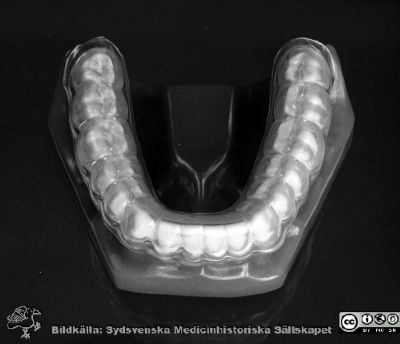 Bettskena 1977
Lasarettet i Lund. Pärm "USiL svart/vitt 1977". Fotografens notering: "Tandprotes". Foto för Åke Svensson på tandpolikliniken. Från negativ. 
Enligt information 22-01-27 från tandläkare Marie-Louise Sibbmark i Rydaholm visar bilderna en bettskena som används vid behandling av tandgnissling. Här sitter den på en modell av en underkäke.
Nyckelord: Lasarettet;Universitet;Universitet;Universitetssjukhus;Odontologi;Tandläkare;Tand;Protes;Tandteknik