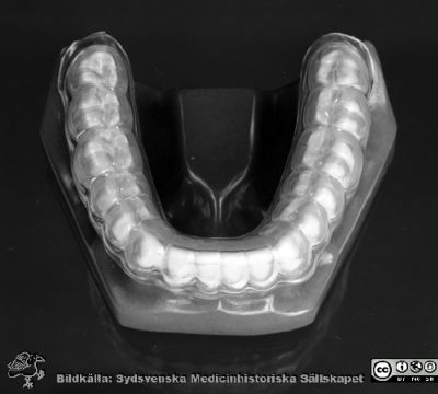 Bettskena 1977
Lasarettet i Lund. Pärm "USiL svart/vitt 1977". Fotografens notering:"Tandprotes". Foto för Åke Svensson på tandpolikliniken. Från negativ. 
Enligt information 22-01-27 från tandläkare Marie-Louise Sibbmark i Rydaholm visar bilderna en bettskena som används vid behandling av tandgnissling. Här sitter den på en modell av en underkäke.
Nyckelord: Lasarettet;Universitet;Universitet;Universitetssjukhus;Odontologi;Tandläkare;Tand;Protes;Tandteknik