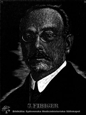 JOHANNES ANDREAS GRIB FIBIGER, 1867 - 1928
Belönad 1926 med Nobelpriset i fysiologi och medicin"för hans upptäckt av spiropteracarcinomet". Reprotryck. Monterat
Nyckelord: Nobelpris;Nobelpristagare;Fysiologi;Medicin;Kapsel 12;Porträtt