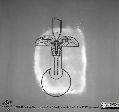 Ett kolostomilås 1953
Pärm äldre neg. 1951-1958, från fotograf Björn Henrikssons samling. MAS Malmö Allmänna Sjukhus. Ur en bildserie 14/3 1953 för prof. Helge B. Wulff som enligt doc. Göran Ekelund (2012) troligen visar ett försök (av många) att hitta på ett "lås" till en stomi för att göra den kontinent. Det har gjorts flera andra försök runt om i världen, men inget har hittills blivit riktigt bra. Negativ, skadat.
Nyckelord: Pärm äldre 1951-58;MAS;Malmö_;Kirurgi;Colostomi;Information;Hantering