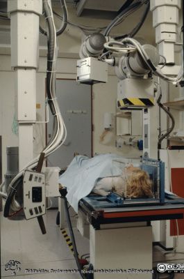 Stereofotogrammetri på röntgenavdelningen i Lund
Ur låda med blandade diabilder från sjukhusfotograferna i Lund, 1970-, 1980- och 1990-talen. Omärkt bild. (Kvinna med huvudet fixerat i genomskinlig låda; röntgenundersökning i två 90gr plan). Detta är sannolikt stereofotogrammetri i samband med käkkirurgiska korrigeringar. Man sköt in små tantalkulor i de skelettdelar som man avsåg att mäta förändringar av läget för i tre dimensioner. Andra tantalkulor fanns fast placerade i plexiglaslådan och genom att mäta inbördes avståndsförändringar kunde man beskriva förflyttningar av t.ex. mandibeln med en noggrannhet på någon tiondels millimeter.
Nyckelord: lLasarettet;Lund;Universitet;Universitetsklinik;USiL;Radiologi;Röntgen;Diagnostik;Stereofotogrammetri