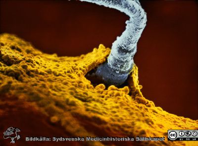 En mänsklig befruktning. En spermie tar sig just in i en äggcell.
Hela spermiens huvud har trängt in i ägget, bara svansen är synlig på äggcellens yta.
Photo: Lennart Nilsson / SCANPIX / code 3056
Nyckelord: Sperm;Spermie;Sperm cell;Sädescell;Sperm cells;Sädesceller;Oocyte;ovum;eEg cell;Äggcell;Ägg;Humant