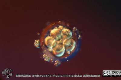 En mänsklig befruktning. A child is born
Ett befruktat mänskligt ägg, tre till fyra (3-4) dygn efter befruktning. Celldelningen fortsätter, ägget är i tidigt i morulastadiem, 16-32 celler.
Photo: Lennart Nilsson / SCANPIX / code 3056
***Special price applies. For usage please contact Scanpix Sweden/Catarina Wahlbeck. Confirmation mandatory prior to any publication***
Nyckelord: Cell division;Celldelning;1 day;1 dag;Humant;Ägg;Morula