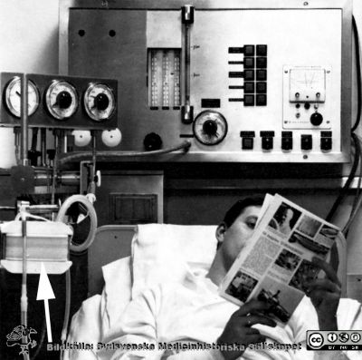 Gambros dialysator AK1 i bruk c:a 1968.
Dialysator AK1 i bruk. Från Gambro-broschyr. AB Gambro c:a 1968. Pilen nedtill till vänster pekar på självadialysfiltret, modell "Ad modum Alwall".
Nyckelord: Dialys;Gambro;Dialysering;Nefrologi;Njursjukdomar;USiL;Universitetssjukhuset;Lund