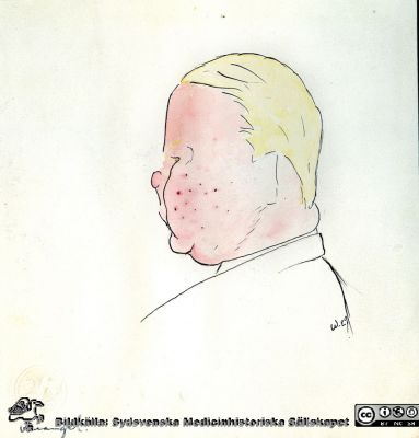 Karikatyr av okänd man Wrangel 
Karikatyr av okänd man Wrangel i ett album märkt "Fortsättningstjänstgöringar 1/12 1928 - 30/4 1929" med ett tjog mycket drivet gjorda karikatyrer av den anonyme signaturen W (Wide?). Flera av karikatyrerna i detta album är namnsatta. Det har 2017 överlämnats till Medicinhistoriska Sällskapet i Lund av professorn i kirurgi i Lund, Christian Ingvar, sonson till Sven Ingvar. Det är upphittat i familjen Ingvars gömmor.
