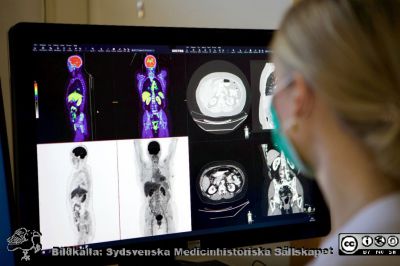 Nuklearmedicinsk PET-DT-undersökning
En läkare granskar PET-DT-bilder. Överst till vänster ses fusionerade PET-DT-bilder, nederst till vänster PET-bilder och på högra delen av skärmen finns DT-bilder. Foto Christoffer Göransson
Nyckelord: Nuklearmedicin;Klinisk kemi;Skintigrafi,Datortomografi,PET-skintigrafi