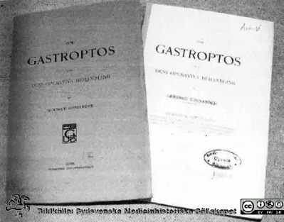 Gertrud Gussanders avhandling 1911 och 1912
Gertrud Gussander blev Sveriges första disputerade kvinnliga kirurg. Hennes avhandling gjordes på ett operationsmaterial från Kristianstad och kom ut i två versioner. Hon startade ett sjukhem i Gagnef, Elfgården. Det blev ett sjukhus som hon framgångsrikt drev.
Nyckelord: Kvinnlig,Kirurg;Sjukhem;Sjukhus