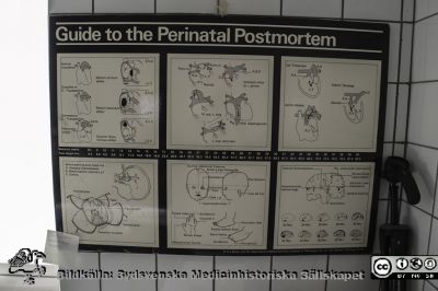 Skylt i avskilt obduktionsrum vid patologiska avdelningen 1962 - 2015. Foto 2013. 
 Bildkälla: certifierade obduktionstekniker Magnus M. Andersson. Den ersattes 2016 av en ny ännu större central obduktionsenhet för hela Skåne.
Nyckelord: Obduktion;Obduktionsavdelning;Obduktionssal;Lasarettet i Lund;Universitetssjukhuset i Lund;Skylt;Perinatal postmortem