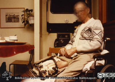 Ortopediska kliniken i Lund 1986. Pataent med lårbensbrott.
Från ortoped klin album 01, Lund. Fotograf Berit Jakobsson. 1986. Pataent med lårbensbrott.
Nyckelord: Lund;Universitetssjukhus;USiL;Kliniker;Ortopedi;Personal;Patienter