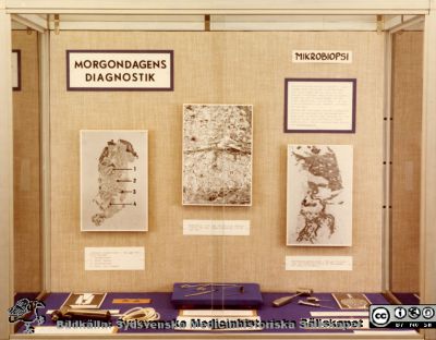 "Morgondagens Diagnostik". En medicinhistorisk monter på Lasarettet i Lund 1976
Morgondagens diagnostik.  Utställning i lasarettets monter i entréhallen på Centralblocket, Lasarettet i Lund.
21/6 1976 -
Nyckelord: Lasarettet;Lund;Universitetssjukhuset;USiL;Utställning;Monter;Centralblocket