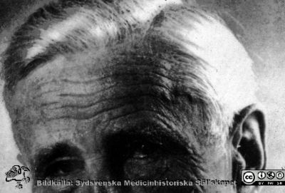 Philip Sandbloms ögon och panna. Kanske 1980-talet?
Omärkt diabild. 
Nyckelord: Lasarettet;Lund;Universitetssjukhuset;USiL;Kirurgiska;Kliniken